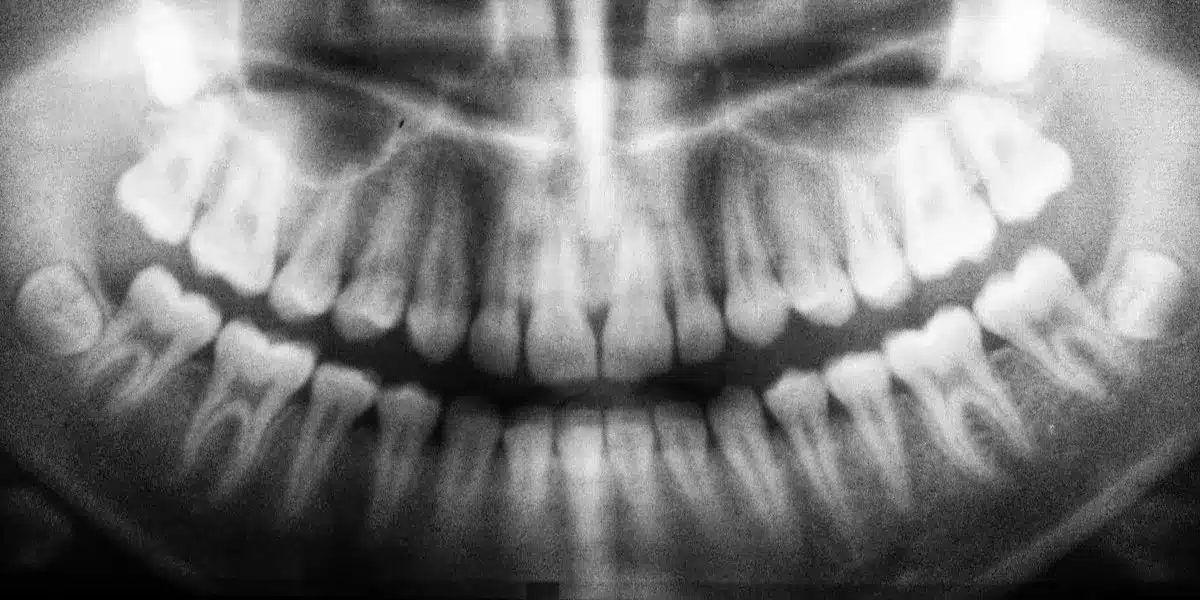 Dental Assistant Night Classes in San Diego
